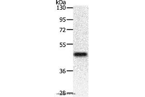 Western blot analysis of Mouse heart tissue, using PDK2 Polyclonal Antibody at dilution of 1:500 (PDK2 antibody)