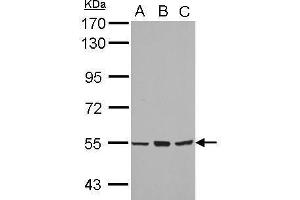 WB Image Sample (30 ug of whole cell lysate) A: A549 B: H1299 C: MCF-7 7. (CYP4B1 antibody  (Center))