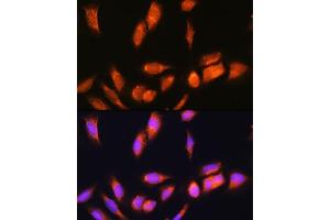 Immunofluorescence analysis of U2OS cells using SCYL2 Rabbit pAb (ABIN6132636, ABIN6147463, ABIN6147465 and ABIN6217078) at dilution of 1:100. (SCYL2 antibody  (AA 1-300))