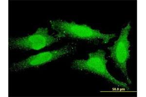 Immunofluorescence of monoclonal antibody to FOXO1 on HeLa cell. (FOXO1 antibody  (AA 556-655))