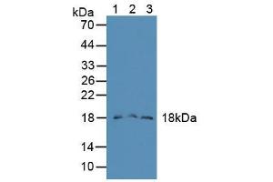 Western blot analysis of (1) Mouse Liver Tissue, (2) Mouse Lung Tissue and (3) Mouse Pancreas Tissue. (FAM19A2 antibody  (AA 31-119))