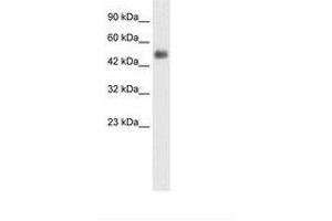 Image no. 3 for anti-Glial Cells Missing Homolog 1 (GCM1) (N-Term) antibody (ABIN6735857) (GCM1 antibody  (N-Term))