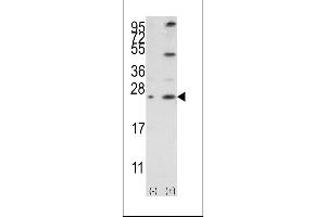 Western blot analysis of Bcl-w3 using rabbit polyclonal Bcl-w BH3 Domain Antibody using 293 cell lysates (2 ug/lane) either nontransfected (Lane 1) or transiently transfected with the BCL2L2 gene (Lane 2). (BCL2L2 antibody  (AA 24-59))