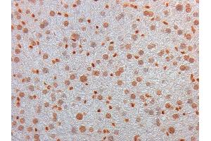 Immunohistochemistry of Mouse Monoclonal anti AKT3 Antibody in Mouse Embryonic Kidney Tissue: Mouse Liver Fixation: FFPE buffered formalin 10% conc Ag Retrieval: Heat, Citrate pH 6. (AKT3 antibody  (Internal Region))