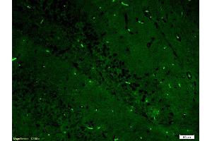 Formalin-fixed and paraffin-embedded rat brain labeled with Anti-ERK2/MAPK1 Polyclonal Antibody, Unconjugated (ABIN723725) 1:200, overnight at 4°C, The secondary antibody was Goat Anti-Rabbit IgG, FITC conjugated used at 1:200 dilution for 40 minutes at 37°C. (ERK1/2 antibody  (AA 301-358))