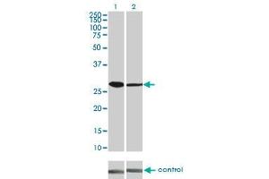 Western blot analysis of CDK4 over-expressed 293 cell line, cotransfected with CDK4 Validated Chimera RNAi (Lane 2) or non-transfected control (Lane 1). (CDK4 antibody  (AA 211-303))
