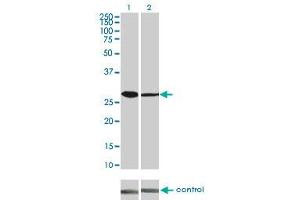 Western blot analysis of CDK4 over-expressed 293 cell line, cotransfected with CDK4 Validated Chimera RNAi (Lane 2) or non-transfected control (Lane 1).