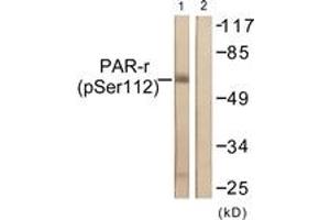 Western blot analysis of extracts from Jurkat cells treated with Paclitaxel 1uM 24h, using PPAR-gamma (Phospho-Ser112) Antibody. (PPARG antibody  (pSer112))