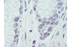 Immunohistochemistry (IHC) image for anti-Cyclin-Dependent Kinase 11B (CDK11B) (C-Term) antibody (ABIN7448470) (CDK11 antibody  (C-Term))