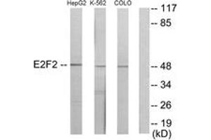 Western blot analysis of extracts from HepG2/K562/COLO205 cells, using E2F2 Antibody. (E2F2 antibody  (AA 221-270))