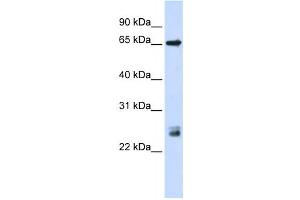 Western Blotting (WB) image for anti-Tripartite Motif Containing 8 (TRIM8) antibody (ABIN2458426) (TRIM8 antibody)