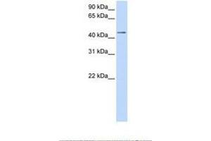 Image no. 1 for anti-Sulfotransferase Family, Cytosolic, 2B, Member 1 (SULT2B1) (AA 144-193) antibody (ABIN6738483) (SULT2B1 antibody  (AA 144-193))