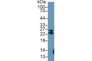 MYL6B antibody  (AA 5-199)