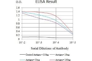 Black line: Control Antigen (100 ng),Purple line: Antigen (10 ng), Blue line: Antigen (50 ng), Red line:Antigen (100 ng) (IL7R antibody  (AA 21-239))