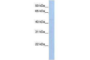 WB Suggested Anti-MAB21L1 Antibody Titration: 0. (MAB21L1 antibody  (N-Term))