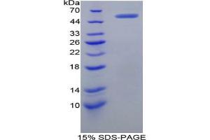 SDS-PAGE analysis of Human Complement Receptor 2 Protein. (CD21 Protein)