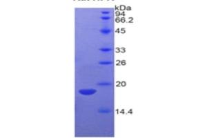 WB of Protein Standard: different control antibodies  against Highly purified E. (Hemopexin ELISA Kit)