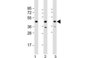 Western blot testing of human 1) 293T/17, 2) Jurkat and 3) K562 cell lysate with PHF6 antibody at 1:2000.