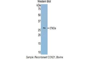 Western Blotting (WB) image for anti-Cyclin D1 (CCND1) (AA 72-272) antibody (ABIN1858282) (Cyclin D1 antibody  (AA 72-272))