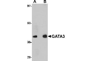 Western Blotting (WB) image for anti-GATA Binding Protein 3 (GATA3) (C-Term) antibody (ABIN1030408) (GATA3 antibody  (C-Term))