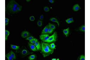 Immunofluorescent analysis of MCF-7 cells using ABIN7158406 at dilution of 1:100 and Alexa Fluor 488-congugated AffiniPure Goat Anti-Rabbit IgG(H+L) (LMF2 antibody  (AA 432-636))