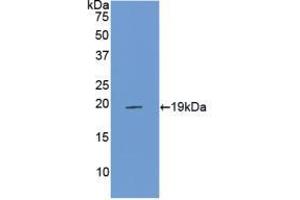 Western blot analysis of recombinant Rat PROCR. (PROCR antibody  (AA 59-217))