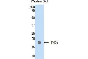 Detection of Recombinant PLXNB1, Human using Polyclonal Antibody to Plexin B1 (PLXNB1) (PLXNB1 antibody  (AA 47-126))