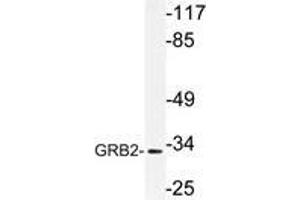 Western blot (WB) analysis of GRB2 antibody in extracts from Jurkat cells. (GRB2 antibody)
