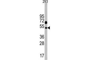 Western blot analysis of Nptx1 Antibody (C-term) in 293 cell line lysates (35 µg/lane). (NPX1 antibody  (C-Term))