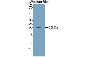 Detection of Recombinant HEXb, Human using Polyclonal Antibody to Hexosaminidase B Beta (HEXb) (HEXB antibody  (AA 122-311))