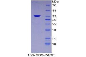 SDS-PAGE (SDS) image for Fucosidase, alpha-L- 1, Tissue (FUCA1) (AA 185-447) protein (His tag) (ABIN2124885) (FUCA1 Protein (AA 185-447) (His tag))