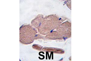 Formalin-fixed and paraffin-embedded human skeletal muscle tissue reacted with MSTN polyclonal antibody  , which was peroxidase-conjugated to the secondary antibody, followed by DAB staining. (MSTN antibody  (AA 17-46))