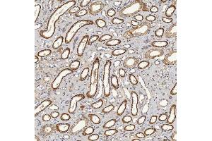 IHC analysis of SFXN5 using anti-SFXN5 antibody (ABIN7601388). (Sideroflexin 5 antibody  (AA 34-340))