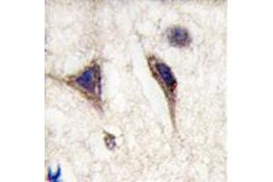 Image no. 2 for anti-Microtubule-Associated Protein tau (MAPT) antibody (ABIN356907) (MAPT antibody)