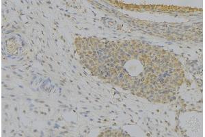 ABIN6277388 at 1/100 staining Human uterus tissue by IHC-P. (IGFBP7 antibody  (Internal Region))