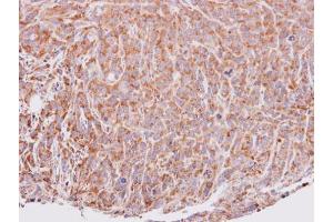 IHC-P Image Immunohistochemical analysis of paraffin-embedded SAS xenograft, using VEGFD, antibody at 1:100 dilution. (VEGFD antibody)