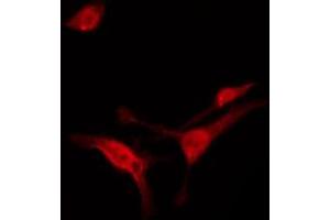 Immunofluorescence (fixed cells) (IF/ICC) image for anti-FYN Oncogene Related To SRC, FGR, YES (FYN) (pTyr530) antibody (ABIN6256757)