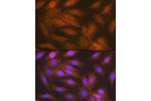 Immunofluorescence analysis of C6 cells using RAIDD/CRADD Rabbit mAb (ABIN7266106) at dilution of 1:100 (40x lens). (CRADD antibody)