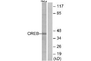 Western blot analysis of extracts from HeLa cells, treated with UV (15mins), using CREB (Ab-129) antibody. (CREB1 antibody  (Ser129))