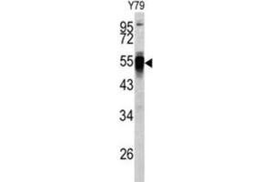 Western Blotting (WB) image for anti-Protein Disulfide Isomerase Family A, Member 6 (PDIA6) antibody (ABIN3002737) (PDIA6 antibody)