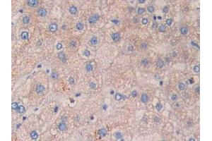 DAB staining on IHC-P; Samples: Human Liver Tissue. (CYFRA21.1 antibody  (AA 244-400))