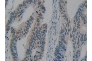 Immunohistochemistry (IHC) image for anti-High Mobility Group Box 1 (HMGB1) (AA 9-163) antibody (ABIN7442177)