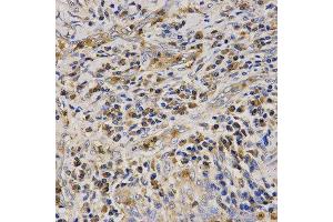 Immunohistochemistry (IHC) image for anti-Cathelicidin Antimicrobial Peptide (CAMP) (AA 31-170) antibody (ABIN3022306) (Cathelicidin antibody  (AA 31-170))