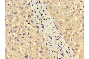 Immunohistochemistry of paraffin-embedded human liver tissue using ABIN7144599 at dilution of 1:100 (ASS1 antibody  (AA 168-222))