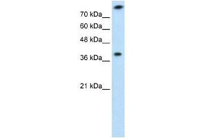 TST antibody used at 1 ug/ml to detect target protein. (TST antibody)
