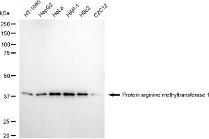 Western blotting analysis using protein arginine methyltransferase 1 antibody (ABIN7799969).