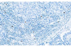 Immunohistochemistry (IHC) image for anti-Granzyme B (GZMB) (AA 19-247) antibody (ABIN7449554)