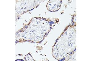 Immunohistochemistry of paraffin-embedded human placenta using LTF antibody (ABIN6131498, ABIN6143382, ABIN6143383 and ABIN6216705) at dilution of 1:100 (40x lens). (Lactoferrin antibody  (AA 500-710))