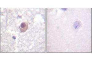 Immunohistochemistry (IHC) image for anti-serum/glucocorticoid Regulated Kinase 1 (SGK1) (AA 41-90) antibody (ABIN1532486)