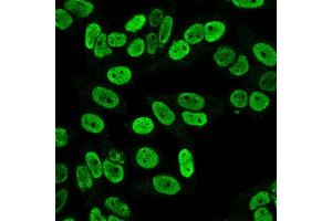 Immunofluorescence Analysis of PFA fixed HeLa cells labeling Cyclin B1 MAb (SPM619)followed by Goat anti-mouse IgG-CF488 (Green). (Cyclin B1 antibody)